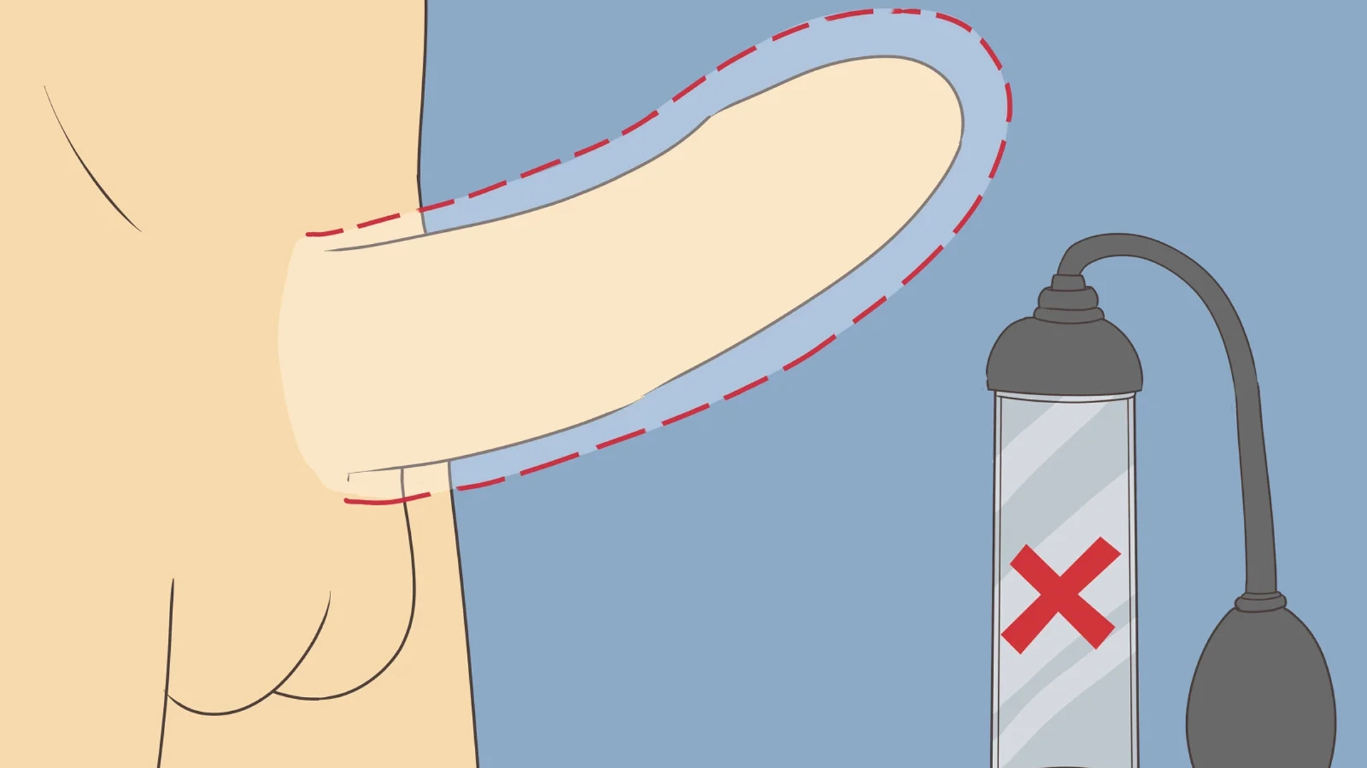 ¿Cómo Funciona Exactamente una Bomba de Vacío?