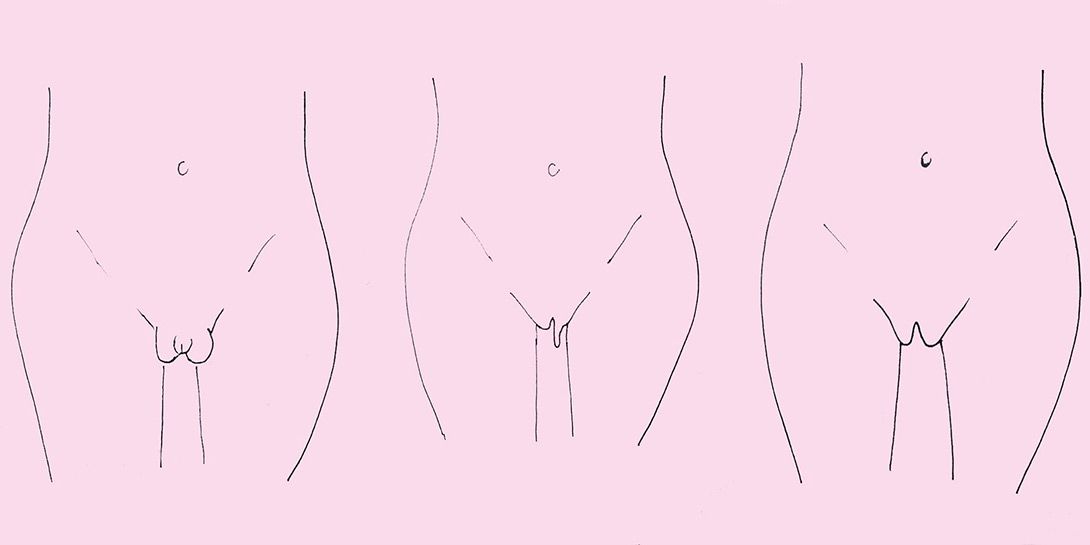 Autoconocimiento ¿Mi Vulva es Normal?
